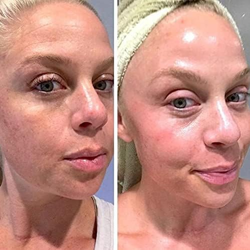 Collagen and Biotin: Why This Duo Deserves a Spot in Your Daily Routine